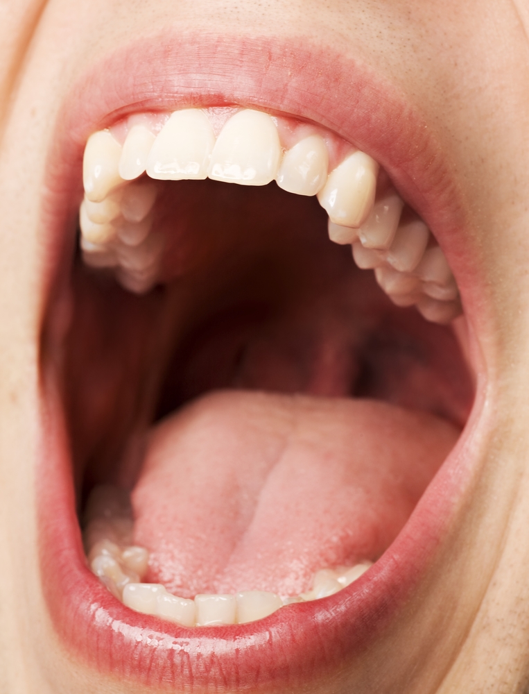 How Does Poor Dental Hygiene Lead To Digestive Issues